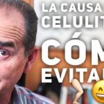 Episodio #20 La Causa De La Celulitis Y Como Evitarla